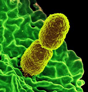 Klebsiella_pneumoniae_18169_thumbnail.jpg