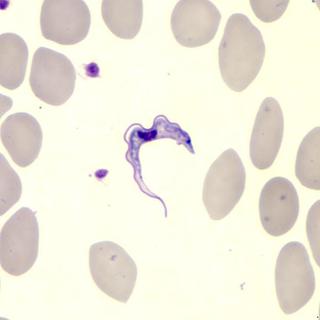 11820_Trypanosoma_brucei_phil_cdc_gov_thumbnail.jpg